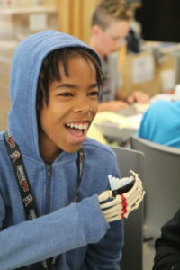 student with a model bone hand up his sleeve